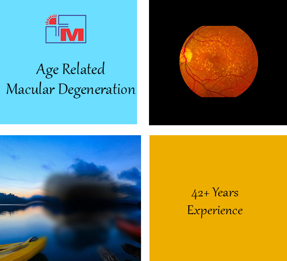 age-related-macular-edema