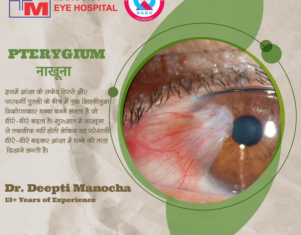 Pterygium surgery | Manocha Eye Hospital | Ambala City | Haryana