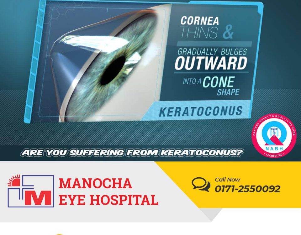 keratoconus treatment in Ambala | Manocha eye hospital | Ambala City