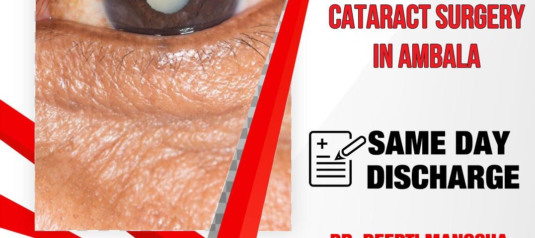 cataract surgery in Ambala | Manocha Eye Hospital | Ambala City