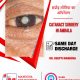cataract surgery in Ambala | Manocha Eye Hospital | Ambala City
